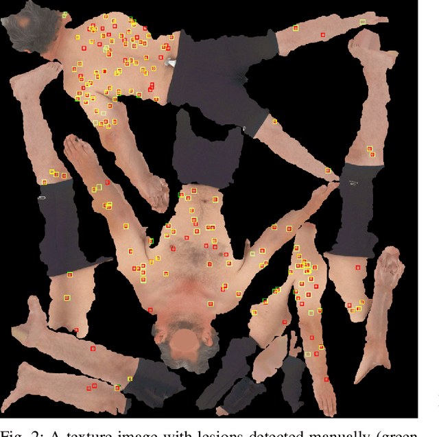 Figure 4 for Detection and Longitudinal Tracking of Pigmented Skin Lesions in 3D Total-Body Skin Textured Meshes