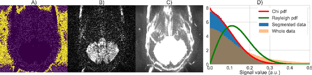 Figure 4 for Automatic, fast and robust characterization of noise distributions for diffusion MRI