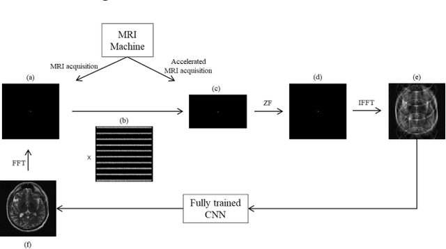 Figure 1 for ERNAS: An Evolutionary Neural Architecture Search for Magnetic Resonance Image Reconstructions
