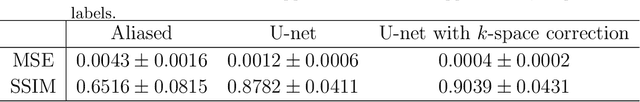 Figure 2 for Deep learning for undersampled MRI reconstruction