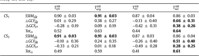 Figure 2 for Adversarial training with cycle consistency for unsupervised super-resolution in endomicroscopy