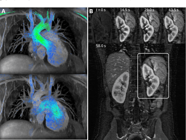 Figure 1 for Compressed Sensing: From Research to Clinical Practice with Data-Driven Learning