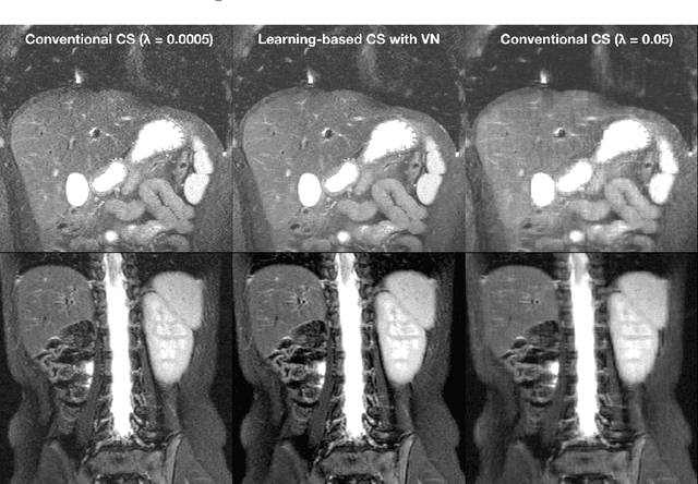Figure 3 for Compressed Sensing: From Research to Clinical Practice with Data-Driven Learning