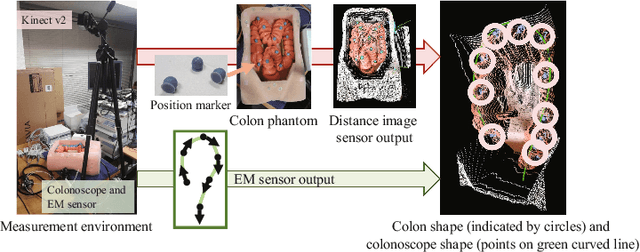 Figure 3 for Colon Shape Estimation Method for Colonoscope Tracking using Recurrent Neural Networks