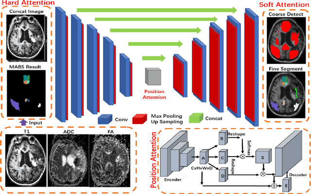 Figure 1 for Robust Brain Magnetic Resonance Image Segmentation for Hydrocephalus Patients: Hard and Soft Attention