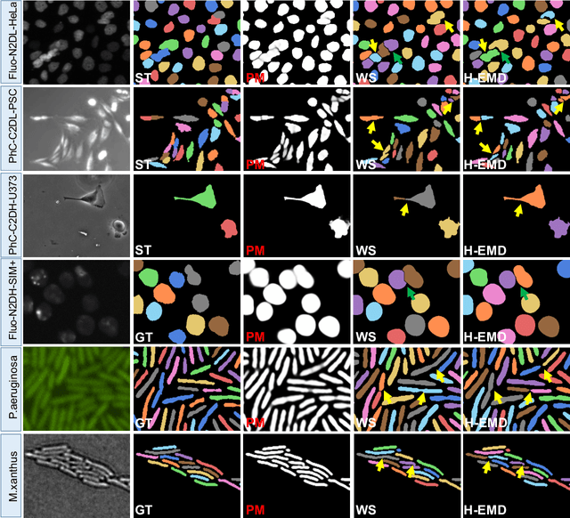 Figure 4 for H-EMD: A Hierarchical Earth Mover's Distance Method for Instance Segmentation