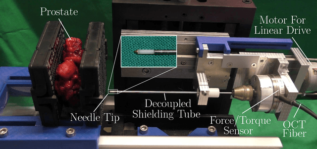 Figure 3 for Needle Tip Force Estimation using an OCT Fiber and a Fused convGRU-CNN Architecture
