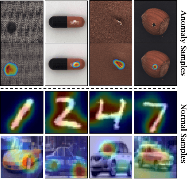 Figure 1 for Multiresolution Knowledge Distillation for Anomaly Detection