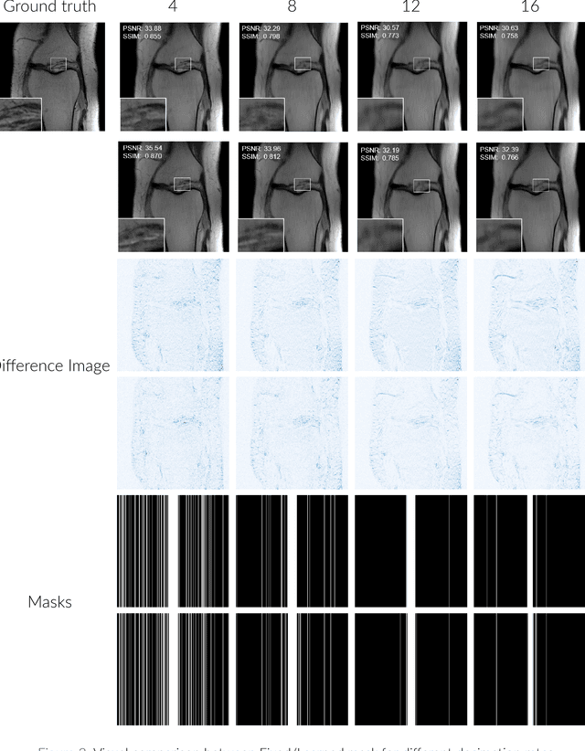 Figure 2 for Learning Fast Magnetic Resonance Imaging