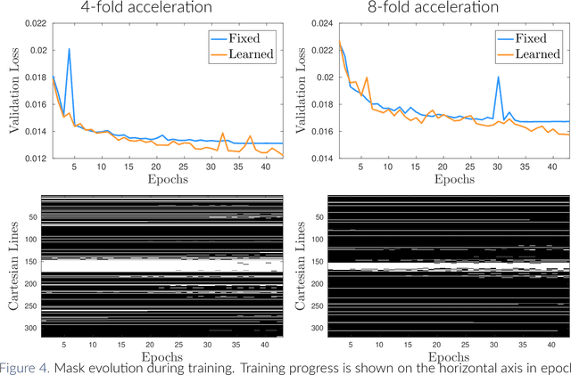 Figure 3 for Learning Fast Magnetic Resonance Imaging