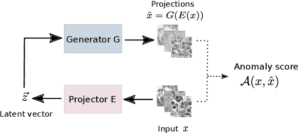 Figure 1 for Unsupervised anomaly detection in digital pathology using GANs