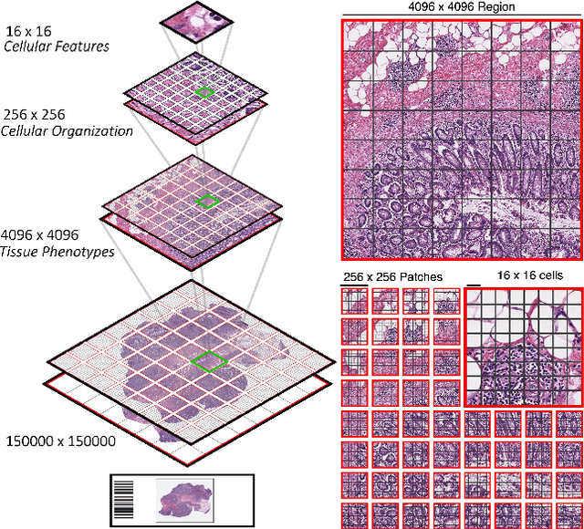 Figure 1 for Scaling Vision Transformers to Gigapixel Images via Hierarchical Self-Supervised Learning