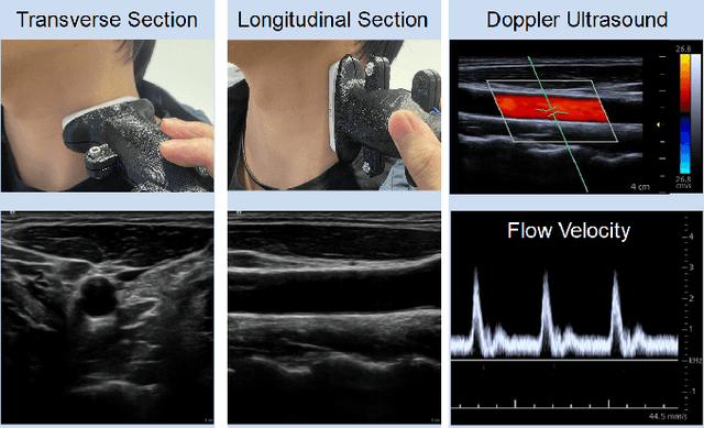 Figure 1 for VesNet-RL: Simulation-based Reinforcement Learning for Real-World US Probe Navigation