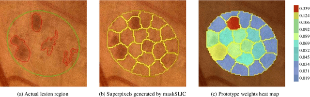 Figure 3 for Coarse Retinal Lesion Annotations Refinement via Prototypical Learning