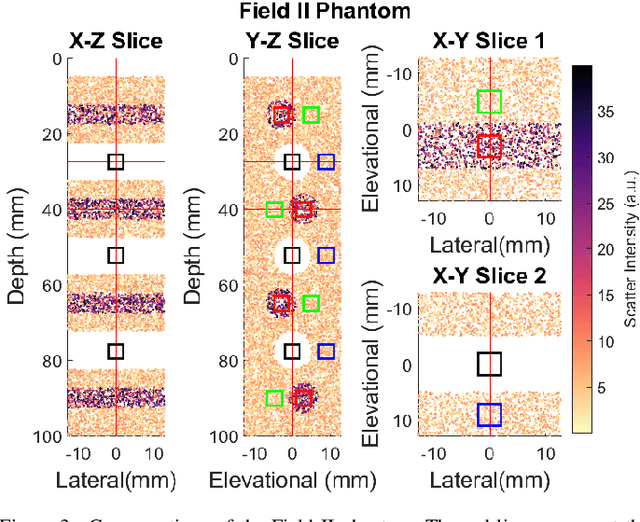 Figure 3 for High contrast Ultrafast 3D Ultrasound Imaging using Row Column specific Frame Multiply and Sum