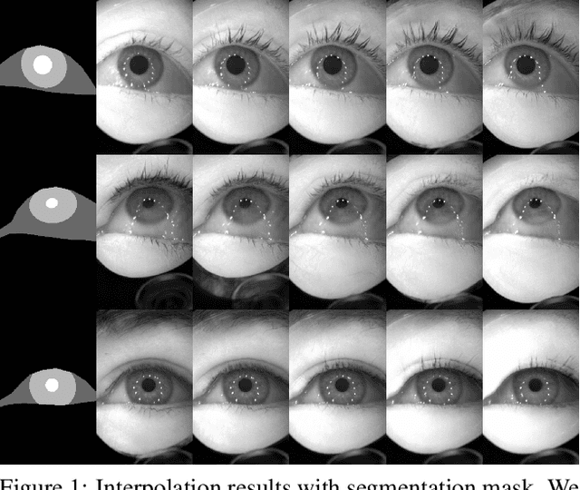 Figure 1 for Content-Consistent Generation of Realistic Eyes with Style