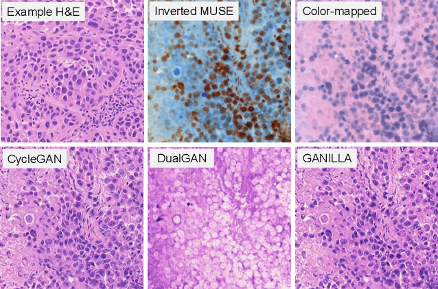 Figure 3 for Slide-free MUSE Microscopy to H&E Histology Modality Conversion via Unpaired Image-to-Image Translation GAN Models