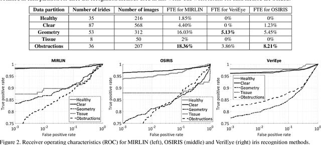 Figure 3 for Assessment of iris recognition reliability for eyes affected by ocular pathologies