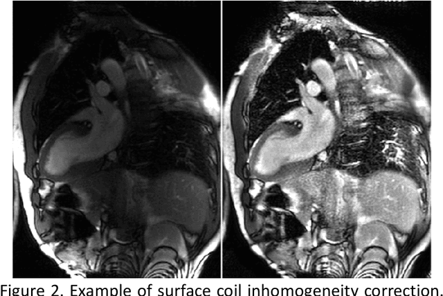 Figure 4 for Landmark detection in Cardiac Magnetic Resonance Imaging Using A Convolutional Neural Network