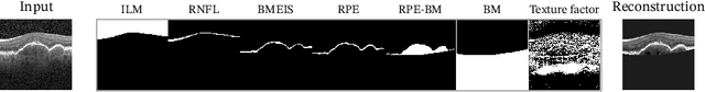 Figure 4 for SD-LayerNet: Semi-supervised retinal layer segmentation in OCT using disentangled representation with anatomical priors