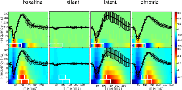 Figure 3 for Decoding Epileptogenesis in a Reduced State Space