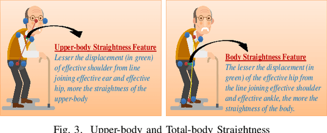 Figure 2 for Detection of Gait Abnormalities caused by Neurological Disorders