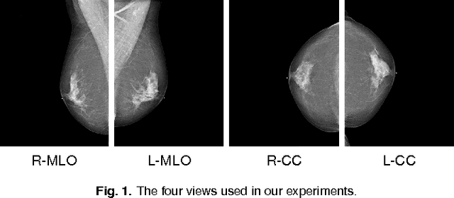 Figure 1 for High-Resolution Breast Cancer Screening with Multi-View Deep Convolutional Neural Networks