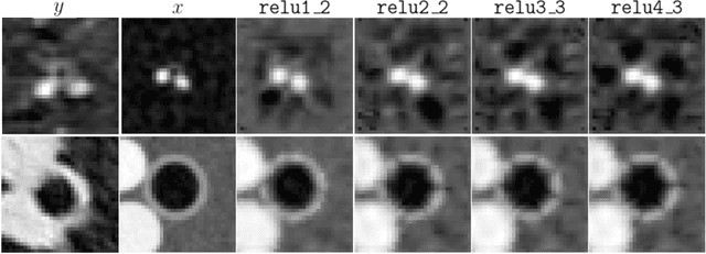 Figure 4 for Airway measurement by refinement of synthetic images improves mortality prediction in idiopathic pulmonary fibrosis