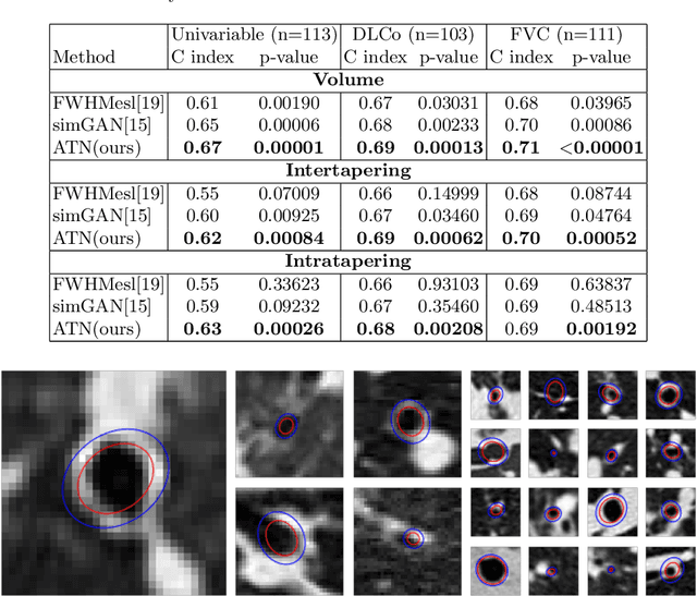 Figure 2 for Airway measurement by refinement of synthetic images improves mortality prediction in idiopathic pulmonary fibrosis
