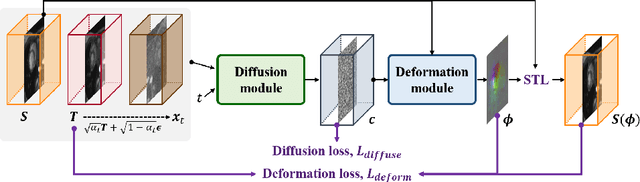 Figure 1 for Diffusion Deformable Model for 4D Temporal Medical Image Generation