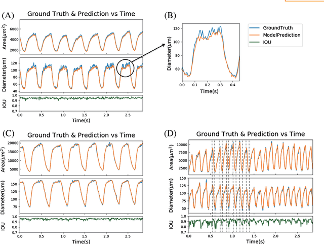 Figure 4 for Segmentation of Drosophila Heart in Optical Coherence Microscopy Images Using Convolutional Neural Networks