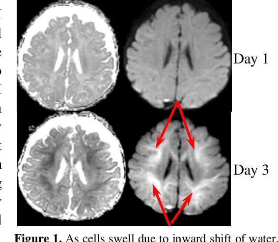 Figure 1 for Deep Learning Mixture-of-Experts Approach for Cytotoxic Edema Assessment in Infants and Children