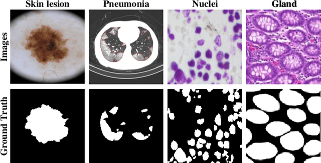 Figure 1 for TransAttUnet: Multi-level Attention-guided U-Net with Transformer for Medical Image Segmentation