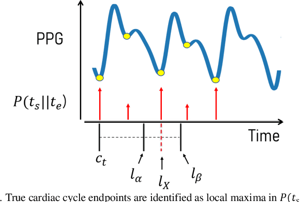 Figure 3 for Boosted-SpringDTW for Comprehensive Feature Extraction of Physiological Signals