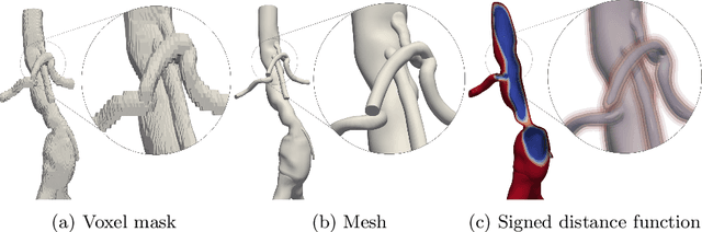 Figure 1 for Going Off-Grid: Continuous Implicit Neural Representations for 3D Vascular Modeling