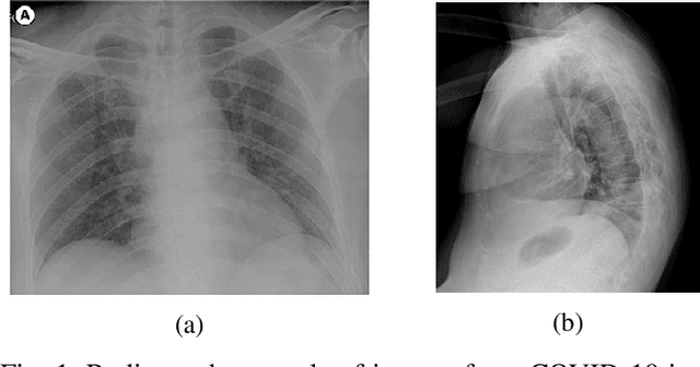Figure 1 for Towards an Effective and Efficient Deep Learning Model for COVID-19 Patterns Detection in X-ray Images
