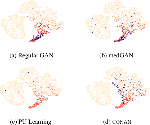 Figure 4 for CONAN: Complementary Pattern Augmentation for Rare Disease Detection