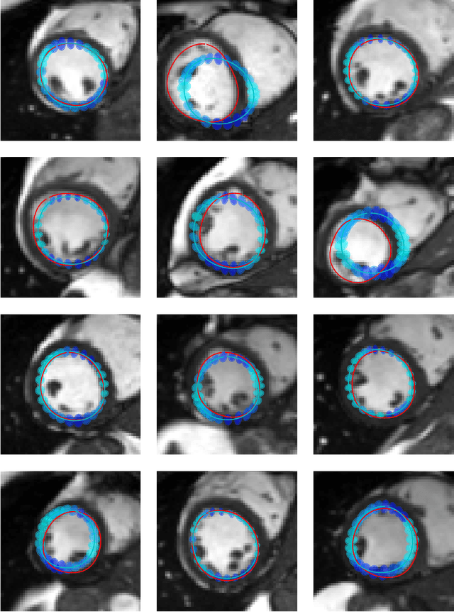 Figure 2 for Uncertainty Quantification in CNN-Based Surface Prediction Using Shape Priors