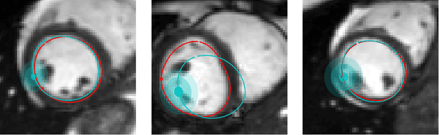 Figure 3 for Uncertainty Quantification in CNN-Based Surface Prediction Using Shape Priors