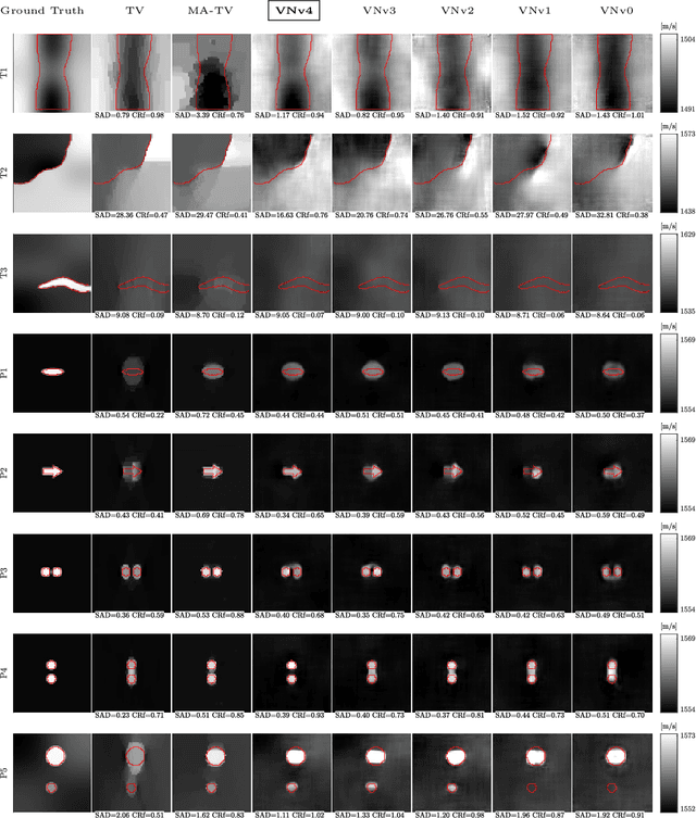 Figure 2 for Image Reconstruction via Variational Network for Real-Time Hand-Held Sound-Speed Imaging