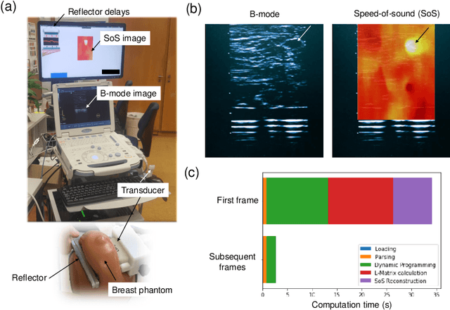 Figure 4 for Image Reconstruction via Variational Network for Real-Time Hand-Held Sound-Speed Imaging