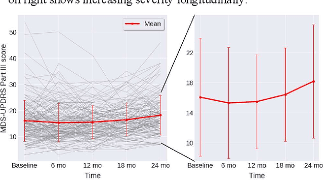 Figure 2 for Prediction of individual progression rate in Parkinson's disease using clinical measures and biomechanical measures of gait and postural stability