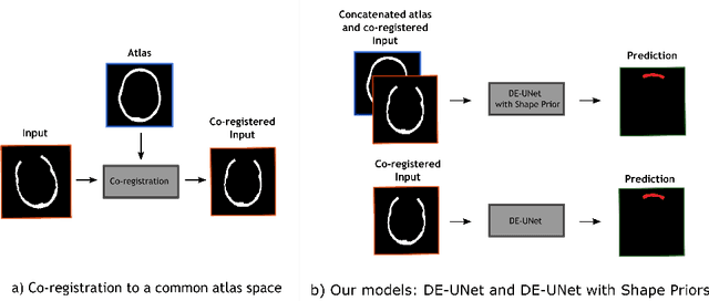 Figure 4 for Cranial Implant Design via Virtual Craniectomy with Shape Priors