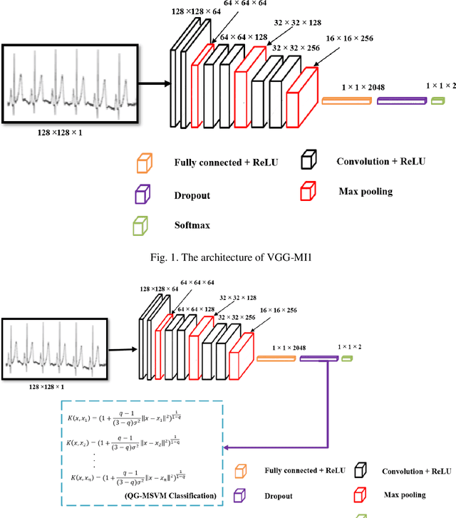 Figure 1 for A Novel Deep Transfer Learning Method for Detection of Myocardial Infarction