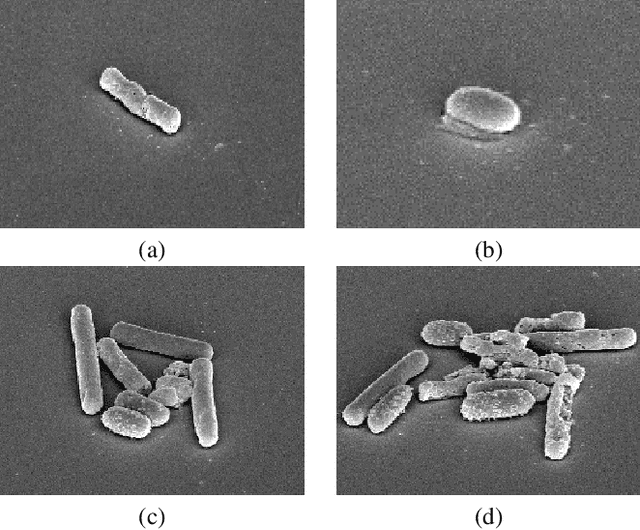 Figure 1 for DETCID: Detection of Elongated Touching Cells with Inhomogeneous Illumination using a Deep Adversarial Network