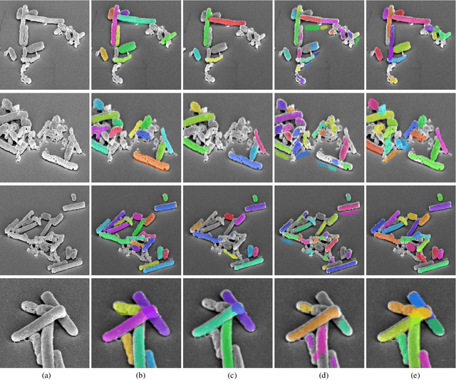 Figure 4 for DETCID: Detection of Elongated Touching Cells with Inhomogeneous Illumination using a Deep Adversarial Network
