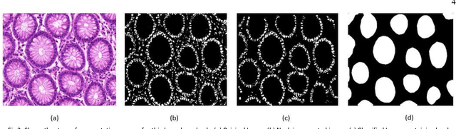 Figure 3 for Gland Segmentation in Histopathology Images Using Random Forest Guided Boundary Construction