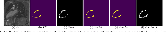 Figure 1 for Deep Statistic Shape Model for Myocardium Segmentation