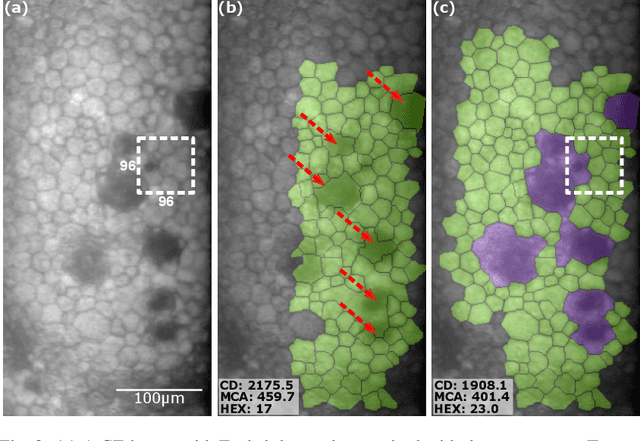 Figure 3 for Corneal endothelium assessment in specular microscopy images with Fuchs' dystrophy via deep regression of signed distance maps