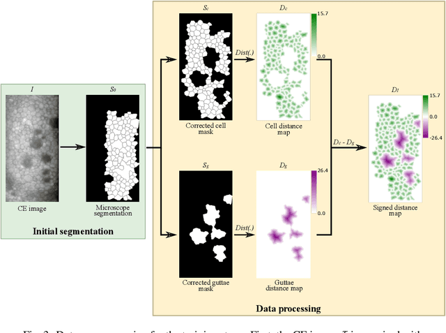 Figure 4 for Corneal endothelium assessment in specular microscopy images with Fuchs' dystrophy via deep regression of signed distance maps